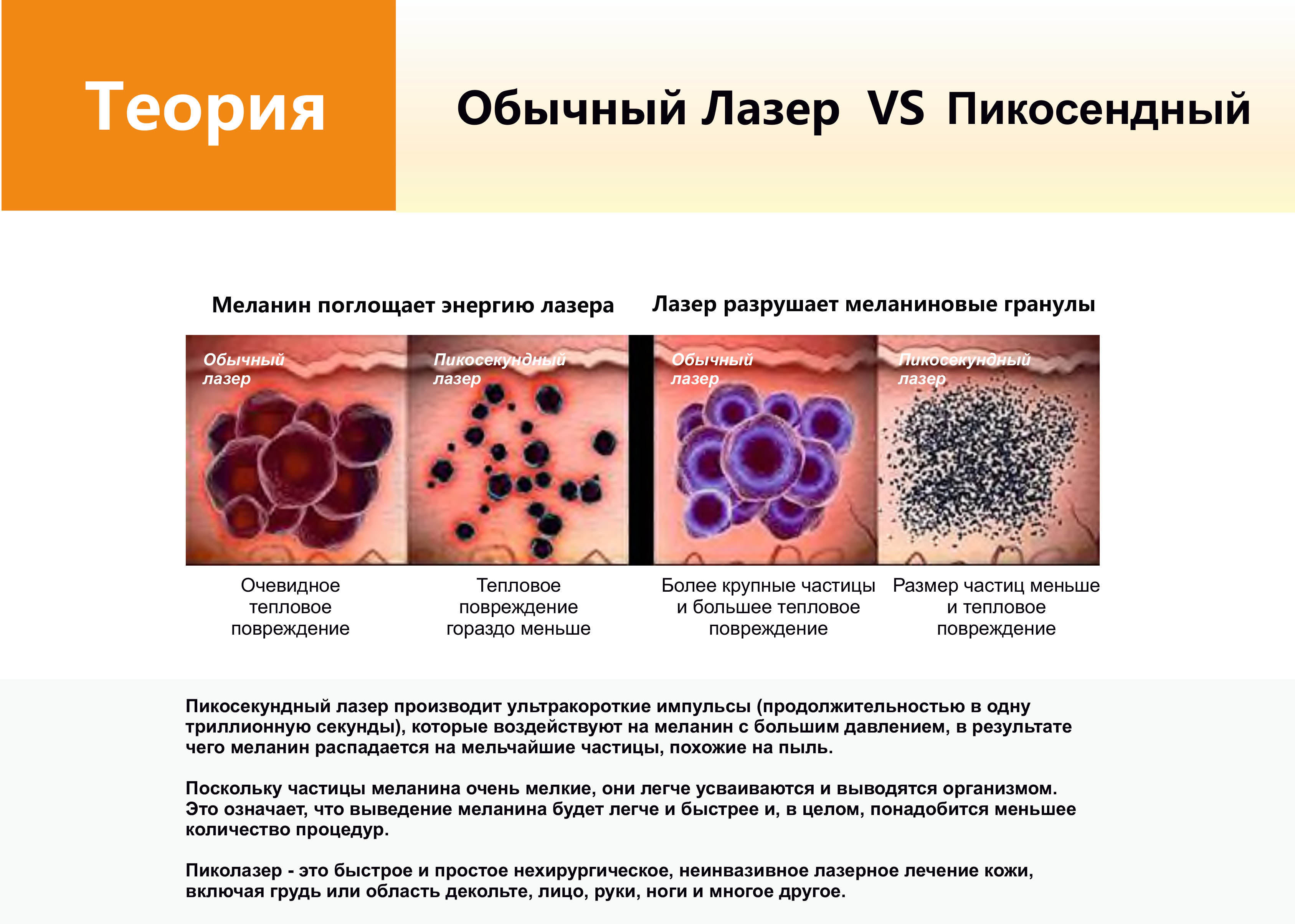 Сравнение обычного лазера и пикосекундного